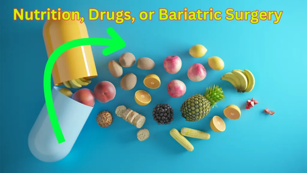 Nutrition, Drugs, or Bariatric Surgery